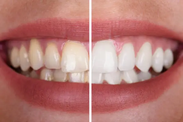 Odontologia Estética